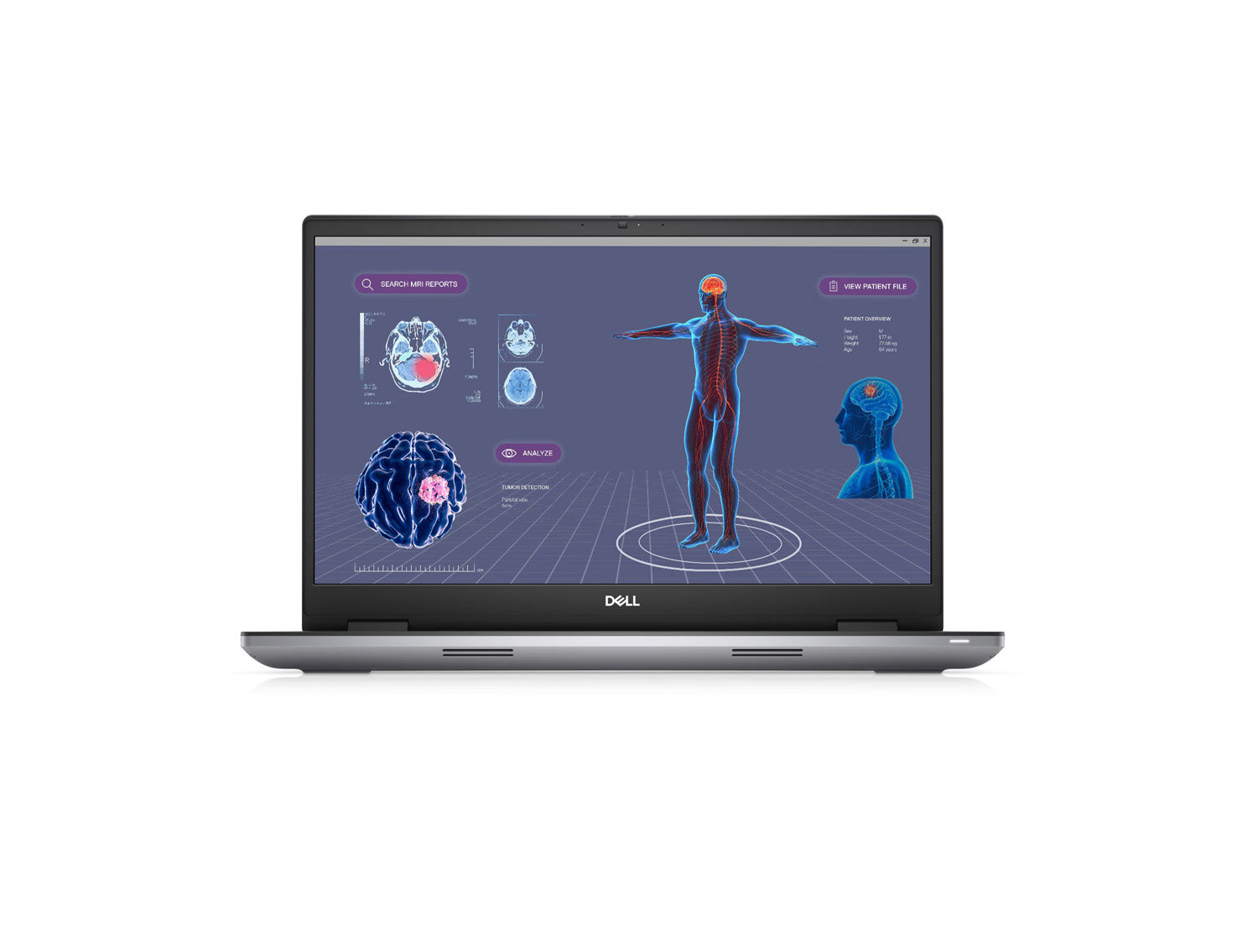 Dell Mobile Precision Workstation 7780 BTX - 13950HX vPro (36 MB cache 24 cores 32 threads up to 5.5 GHz 55 W), 64GB 1x64GB 5200MT/s CAMM non, 1 TB M.2 2280 Gen 4 PCIe NVMe SSD